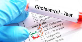 good vs bad cholesterol; HDL vs LDL